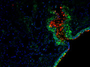 Inflamed mouse lung. Infiltrating innate immune cells are stained in red and green. Credit: Meera Nair, PhD, Michael Abt, PhD, and David Artis, PhD, Perelman School of Medicine, University of Pennsylvania.